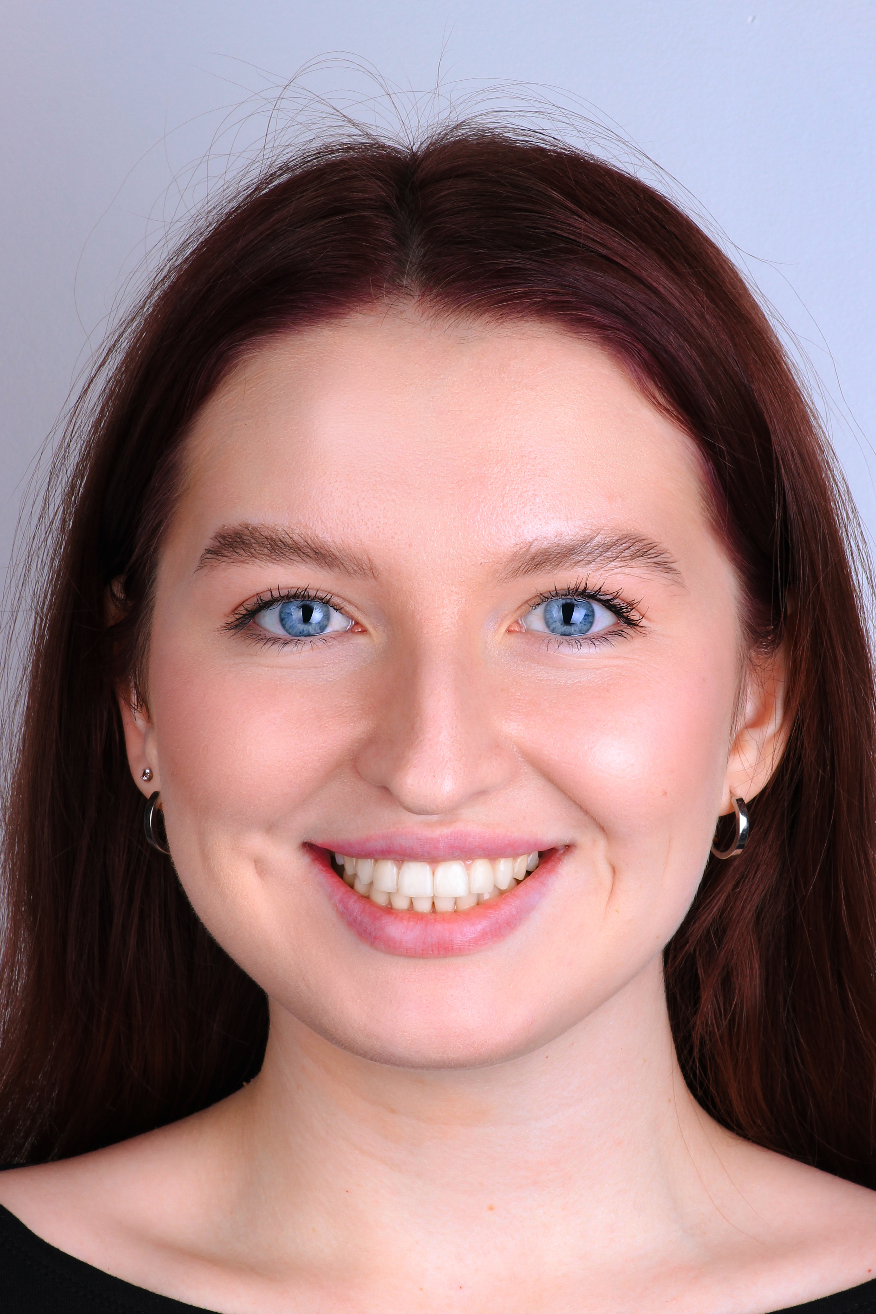 Кейс Тараскиной - после лечения